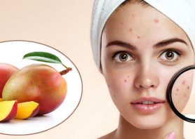 ۹ راه برای از بین لکه های قرمز روی پوست