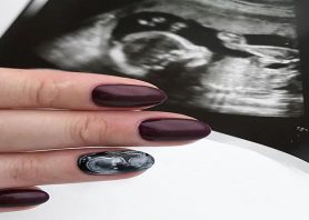 طراحی ناخن با استفاده از عکس سونوگرافی جنین