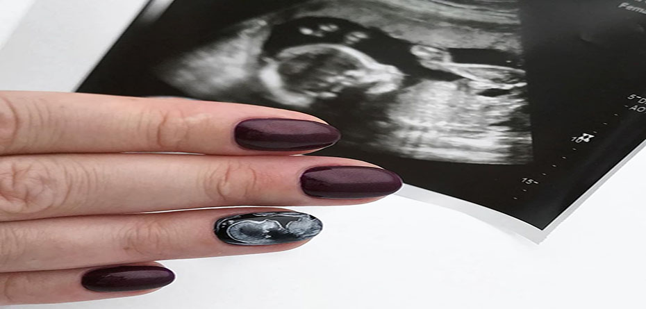 طراحی ناخن با استفاده از عکس سونوگرافی جنین